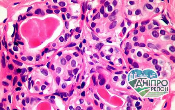 Клітина, що вбиває рак