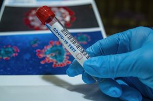 Коронавірус у Дніпрі та області: статистика на 30 серпня