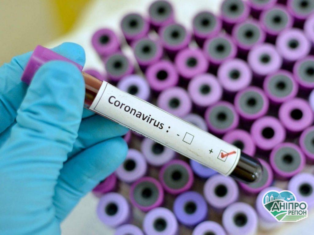 Новини Дніпра. Коронавірус у Дніпрі: статистика на ранок 22 вересня