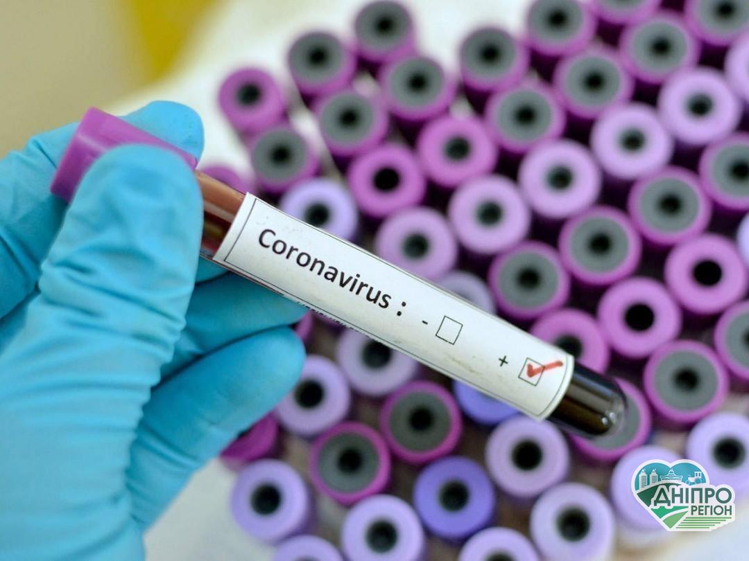 COVID-19: на Днепропетровщине за сутки зафиксировано 39 новых случая