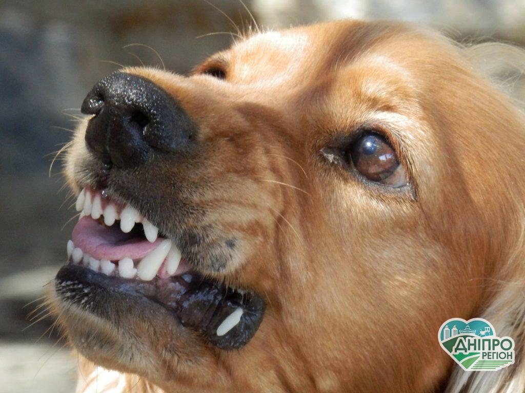 Під Дніпром собака покусала дитину: власник не поспішав забрати тварину