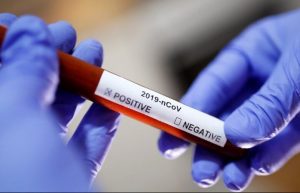 Коронавирус: в Днепре и области выявили 76 новых случаев COVID-19