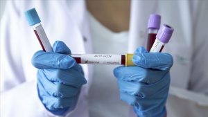 Коронавірус у Дніпрі та області: статистика на 10 грудня