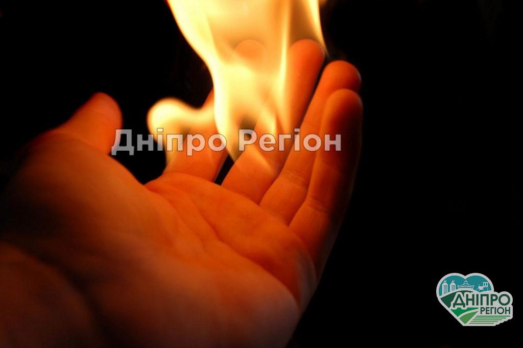 У Кривому Розі 17-річний співмешканець підпалив свою вагітну 20-річну дівчину У Кривому Розі 17-річний співмешканець підпалив свою вагітну 20-річну дівчину