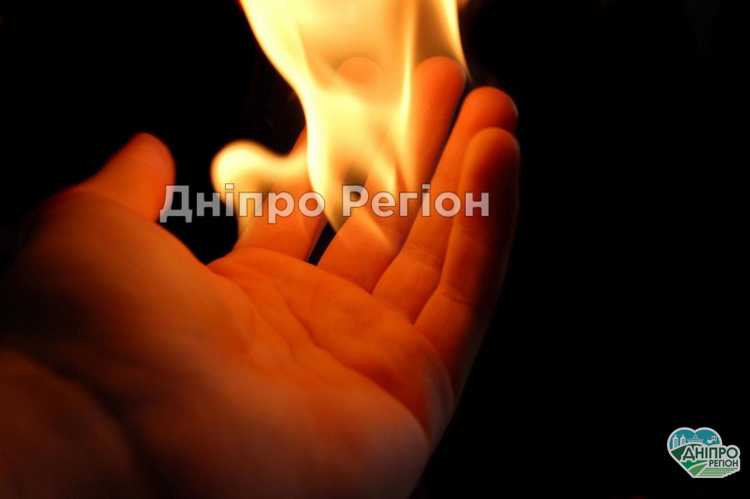 У Кривому Розі 17-річний співмешканець підпалив свою вагітну 20-річну дівчину