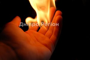 У Кривому Розі 17-річний співмешканець підпалив свою вагітну 20-річну дівчину