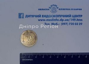 У Дніпрі медики врятувала хлопця, який проковтнув 10-гривневу монету (Фото)