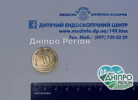 У Дніпрі медики врятувала хлопця, який проковтнув 10-гривневу монету (Фото) У Дніпрі медики врятувала хлопця, який проковтнув 10-гривневу монету (Фото)