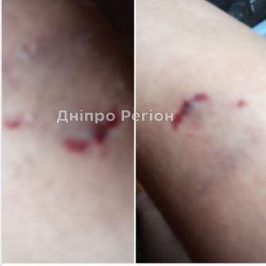 У Новомосковську собаки атакують велосипедистів та гризуть за ноги (ФОТО)