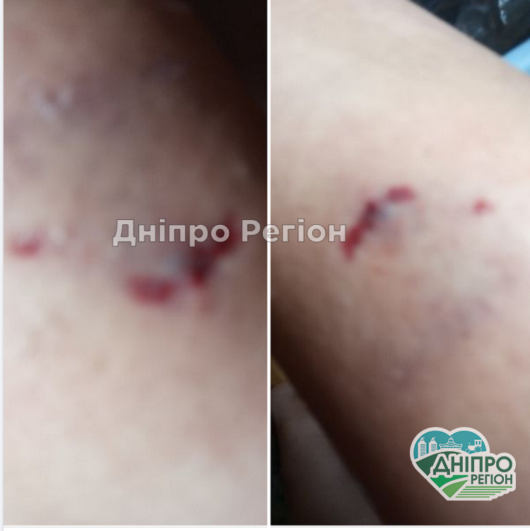 У Новомосковську собаки атакують велосипедистів та гризуть за ноги (ФОТО) У Новомосковську собаки атакують велосипедистів та гризуть за ноги (ФОТО)