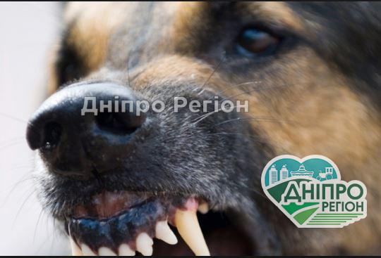 Службовий пес накинувся на чоловіка: під Дніпром на пляжі виник конфлікт між охоронцем та відпочиваючим Службовий пес накинувся на чоловіка: під Дніпром на пляжі виник конфлікт між охоронцем та відпочиваючим