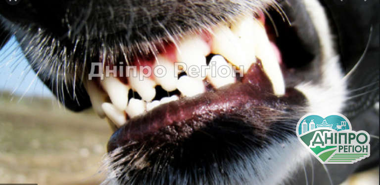 Вкусила за руку: у Дніпрі на житловому масиві Тополя собака напала на дівчину