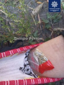 На Дніпропетровщині обабіч траси лежить 15-річний хлопець і втрачає свідомість (ФОТО)