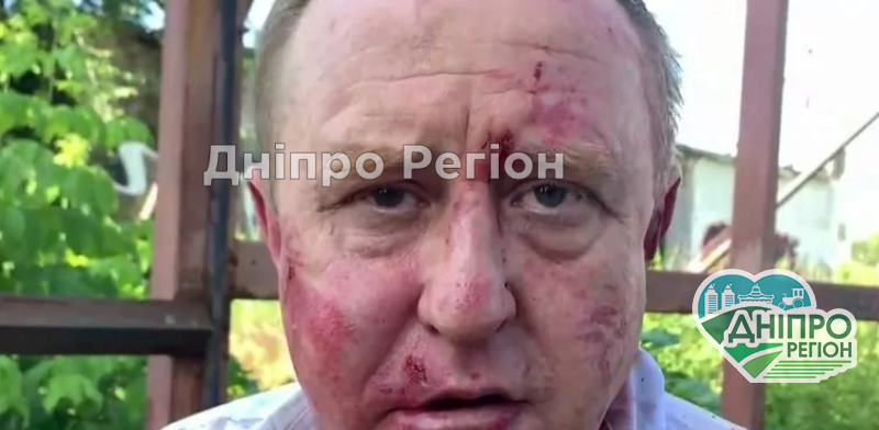 У Запоріжжі затримали педофіла із Дніпропетровщини: відомі подробиці У Запоріжжі затримали педофіла з Дніпропетровщини: відомі подробиці