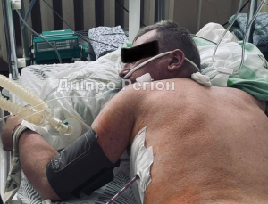 Чоловік, батько, брат повернеться до родини: у Дніпрі врятували пацієнта з онкологією і COVID