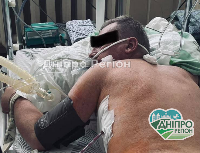 Чоловік, батько, брат повернеться до родини: у Дніпрі врятували пацієнта з онкологією і COVID Чоловік, батько, брат повернеться до родини: у Дніпрі врятували пацієнта з онкологією і COVID