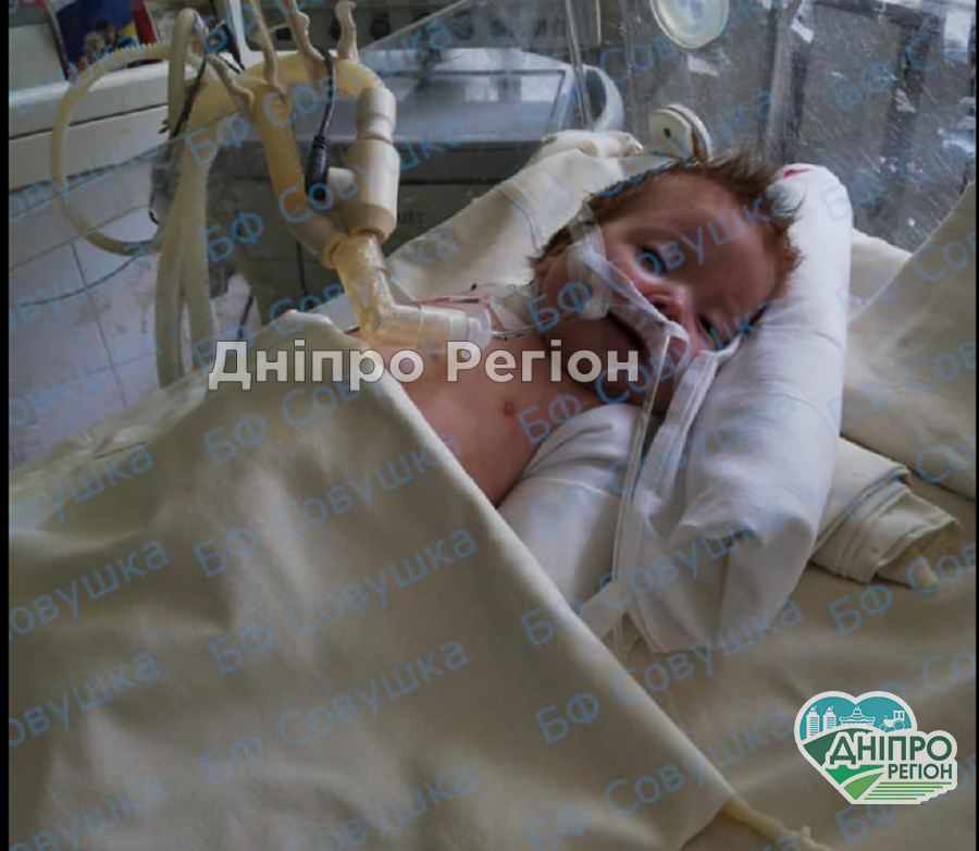 Даня пережив 2 зупинки серця: у Дніпрі рятують 3-місячного хлопчика, стан дитини вкрай важкий Даня пережив 2 зупинки серця: у Дніпрі рятують 3-місячного хлопчика, стан дитини вкрай важкий