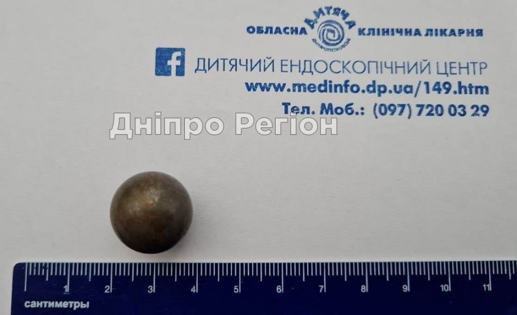 У Дніпрі врятували дитину, яка ковтнула конструктор Лего (ФОТО)