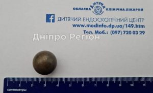 У Дніпрі врятували дитину, яка ковтнула конструктор Лего (ФОТО)