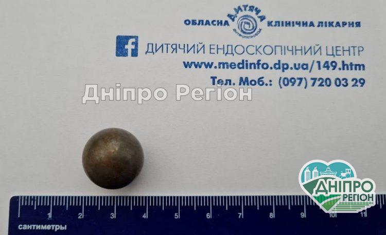 У Дніпрі врятували дитину, яка ковтнула конструктор Лего (ФОТО)