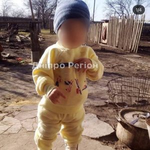 У Дніпрі спасають дворічного малюка, якого вітчим пошматував ножем