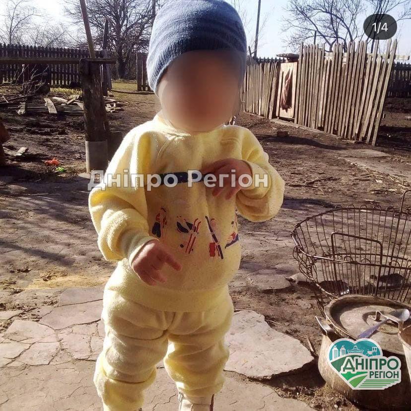 У Дніпрі спасають дворічного малюка, якого вітчим пошматував ножем У Дніпрі спасають дворічного малюка, якого вітчим пошматував ножем
