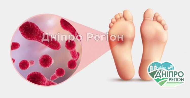 В Україні в цьому році вперше діагностували випадок правця В Україні в цьому році вперше діагностували випадок правця