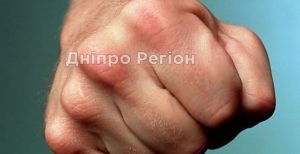 У Нікополі вночі побили і пограбували хлопця, забрали речі та одяг