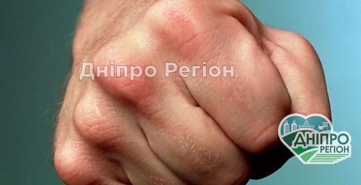 У Нікополі вночі побили і пограбували хлопця, забрали речі та одяг Зняли одяг та забрали всі речі: у Нікополі вночі побили і пограбували хлопця