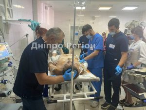 В квартиру влетіли 2 снаряди: У Дніпрі рятують життя чоловіка з Красногорівки
