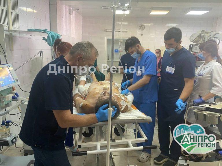 Пив чай на кухні, а в квартиру прилетіли 2 снаряди: у Дніпрі рятують життя чоловіка з Красногорівки