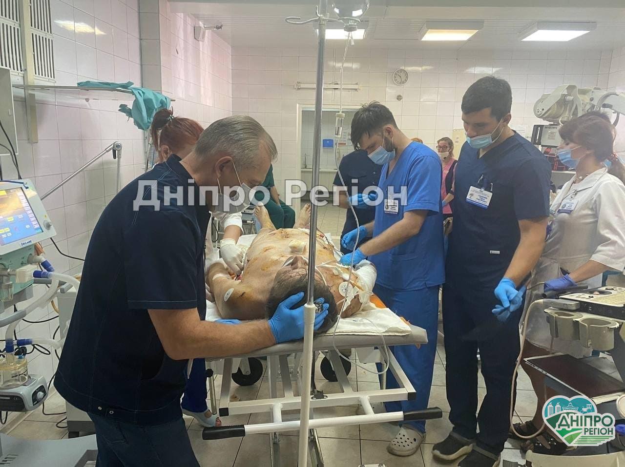 Пив чай на кухні, а в квартиру прилетіли 2 снаряди: у Дніпрі рятують життя чоловіка з Красногорівки