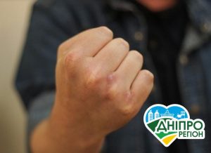 Ударив продавця, бо попросила надіти маску: у Нікополі поліція затримала покупця