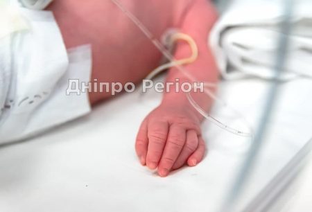 У Дніпрі новонародженому зупинили серце на 5 годин
