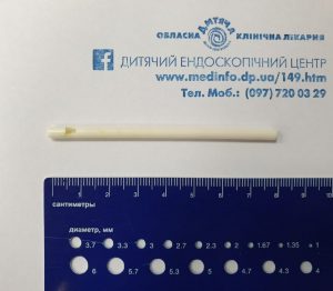 У Дніпрі у стравоході дитини застрягла паличка від Чупа чупсу