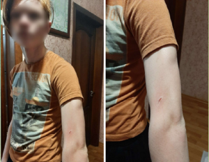 Врятувала товста куртка: у Дніпрі зграя бродячих собак напала на підлітка