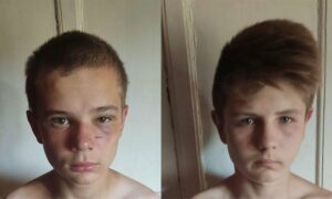 У Дніпрі поліція розшукує двох хлопців, які втекли з лікарні (Фото)