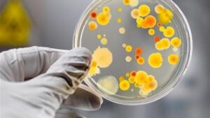У Дніпрі у ресторані виявили сальмонельоз