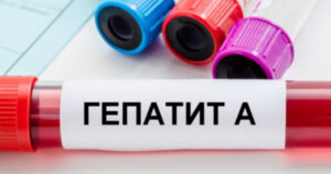 Що таке Гепатит А і як від нього вберегтися: симптоми та профілактика