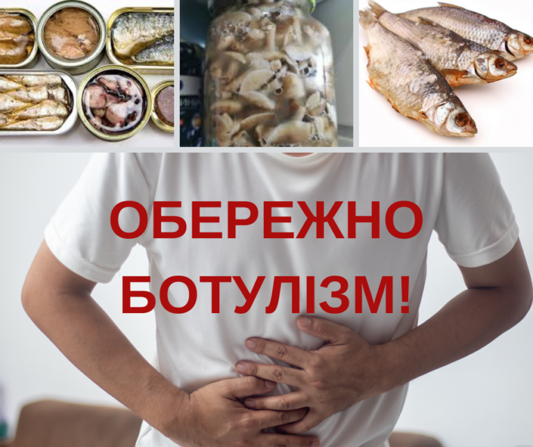 На Дніпропетровщині зареєстровано третій випадок захворювання на ботулізм