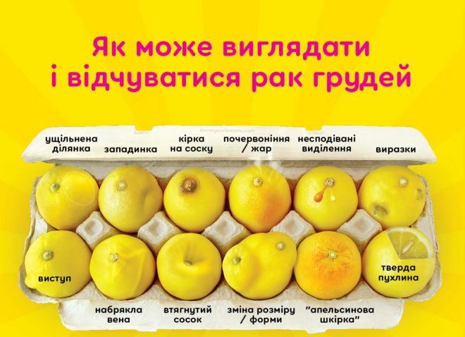 Рак грудей: лікар-онколог з Дніпра розповів, як вчасно виявити хворобу та пройти мамографію безкоштовно