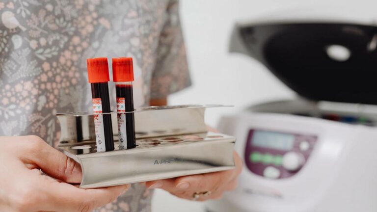 Перед Новим роком позитивна динаміка. Про епідемічну ситуацію на Дніпропетровщині