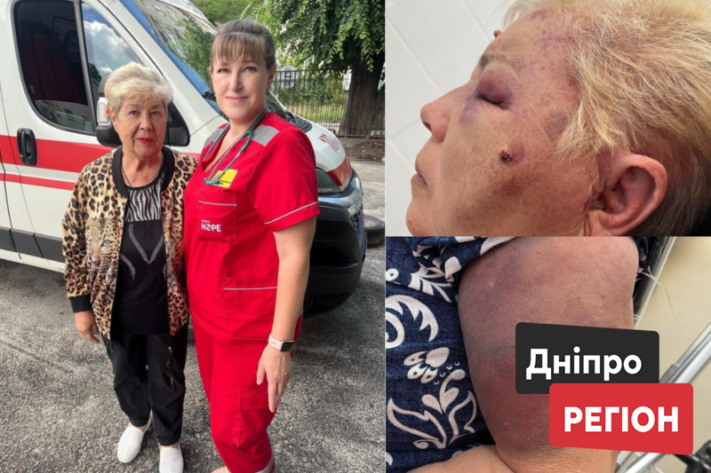 На Дніпропетровщині медики врятували 73-річну жертву домашнього насильства