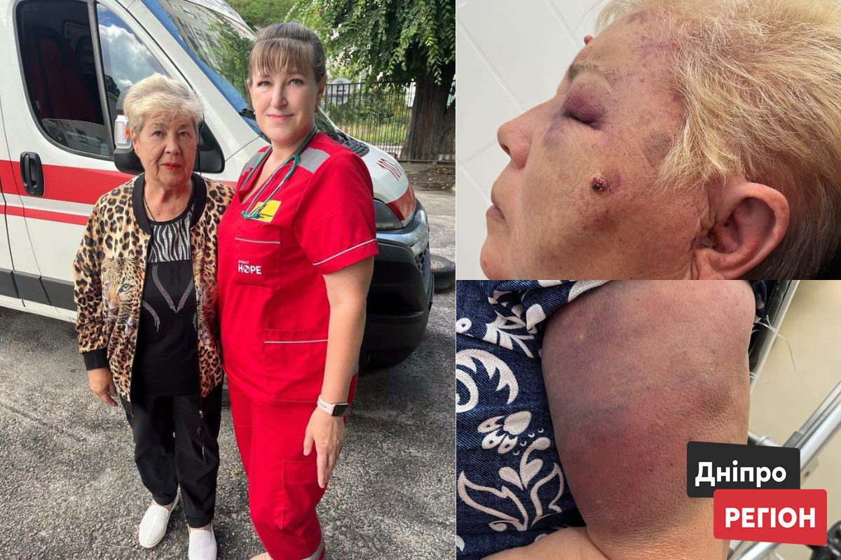 У місті Самар медики врятували 73-річну жінку